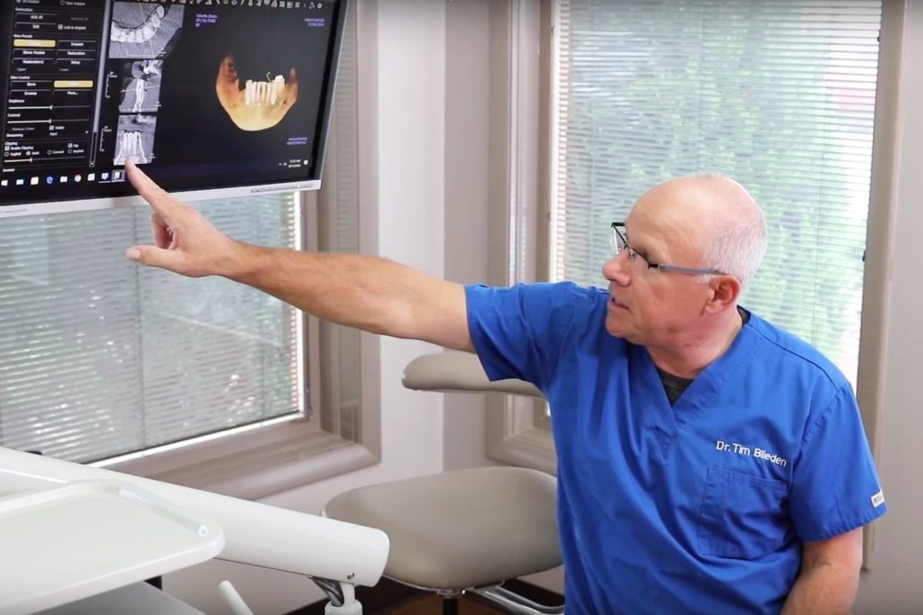 Dental Implants Rochester, NY Periodontal Centers of Rochester