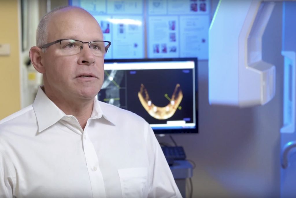 Full Arch Dental Implants Rochester, NY Implant Dentistry